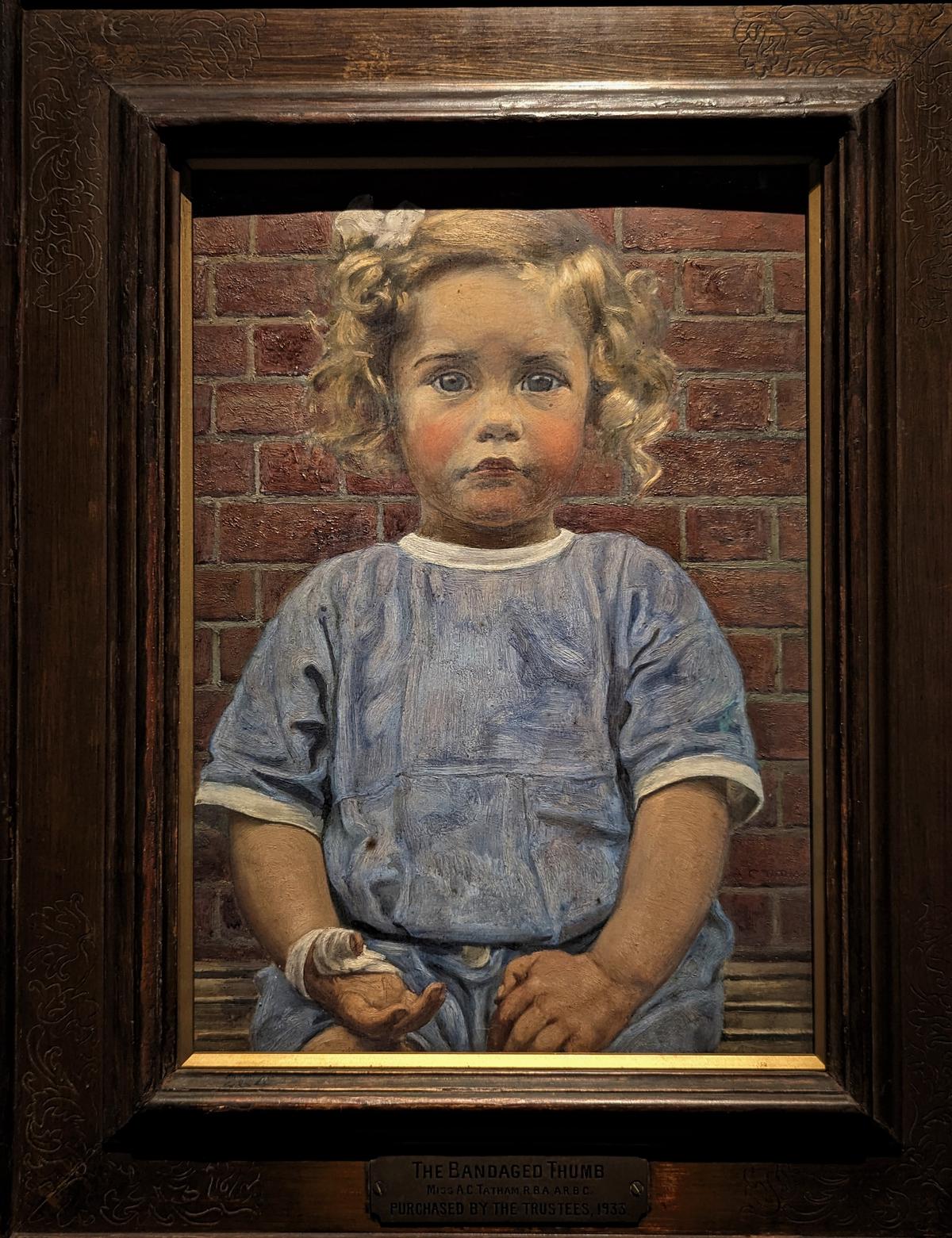 A 20th century painting titled, ‘The bandaged thumb’ by British artist Agnes Clara Tatham is featuring her three-year-old niece, Agnes Kjaerulf Knudsen, as the subject.